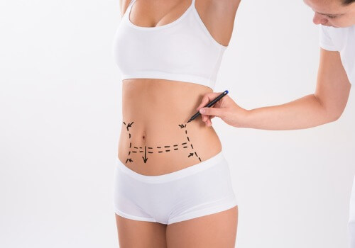 surgeon-preparing-woman-for-liposuction-surgery-picture-id609695754 surgeon-preparing-woman-for-liposuction-surgery-picture-id609695754